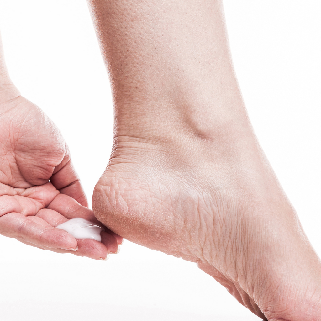 Moisturizing Foot Cream – Urea Infused for Repairing Cracked Heels & Dry Feet – Soft, Smooth Skin – 100g