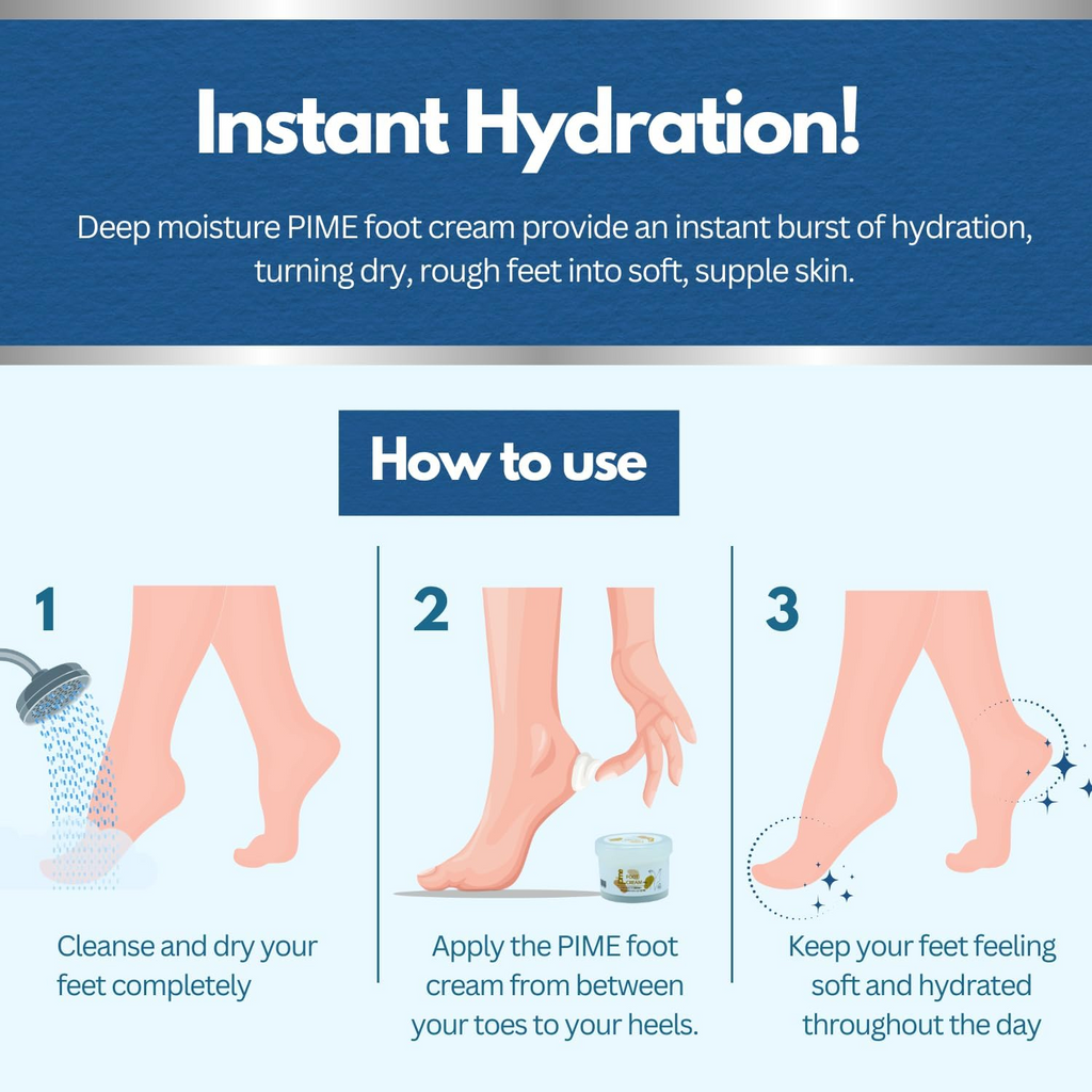 Moisturizing Foot Cream – Urea Infused for Repairing Cracked Heels & Dry Feet – Soft, Smooth Skin – 100g