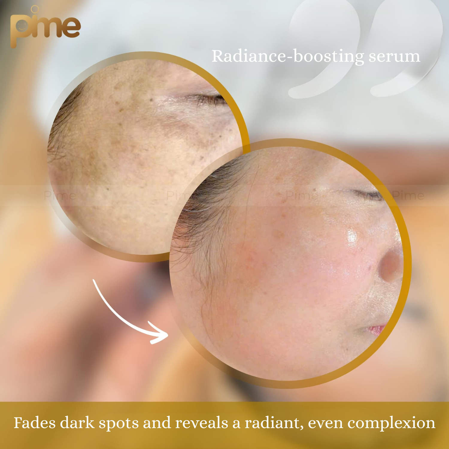 Niacinamide & Peptide Face Serum – 25K Gold Infusion, Anti-Aging, Firming & Brightening – 5ml x5